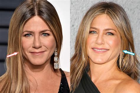 jennifer aniston before and after|jennifer aniston new face.